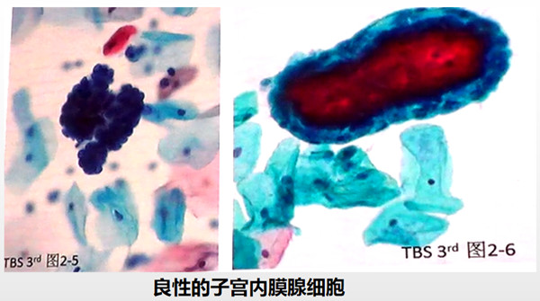 女性检查 限女性 Pet Ct防癌检查 深圳慈惠健康管理有限公司